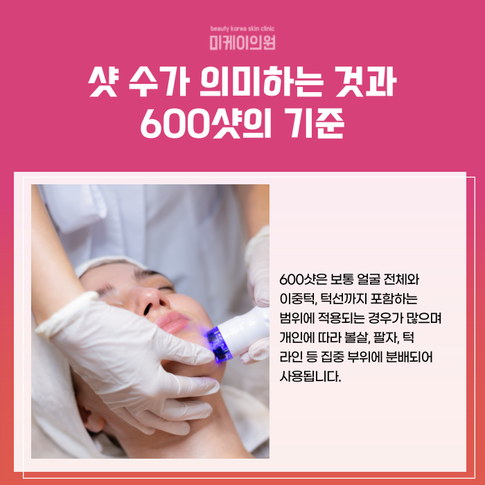 Gangnam Ulthera 600 Shots: Pain, Effects, and Duration image 2