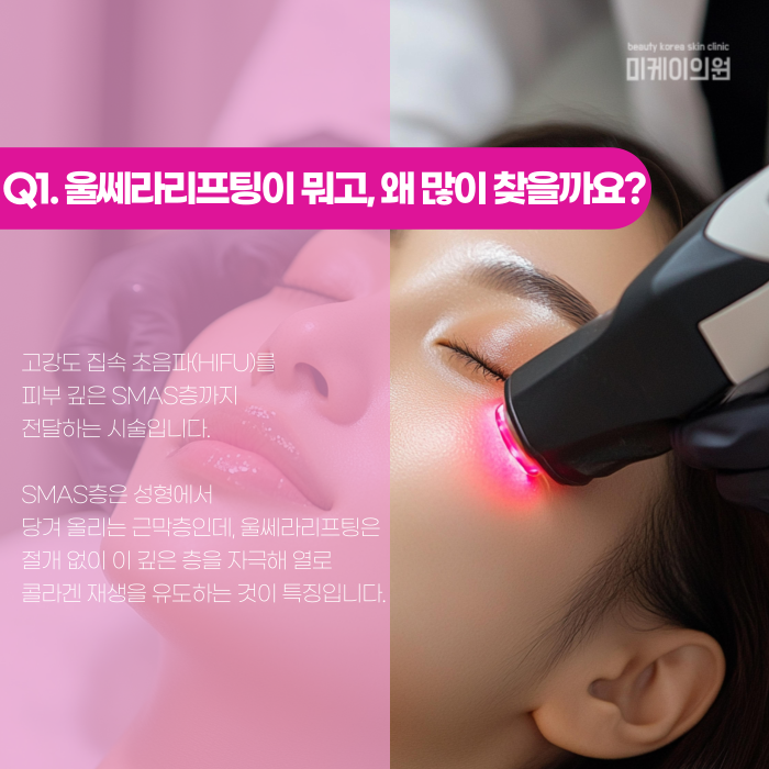 Gangnam Ultherapy Lifting: When Do the Effects Start to Show? image 2