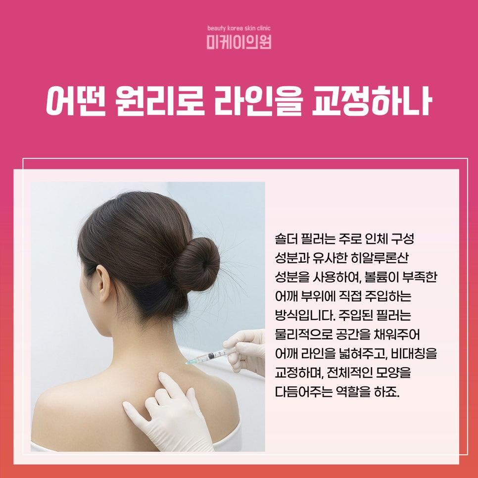 강남 어깨필러 효과, 부작용 제대로 알아보기 관련 이미지 2