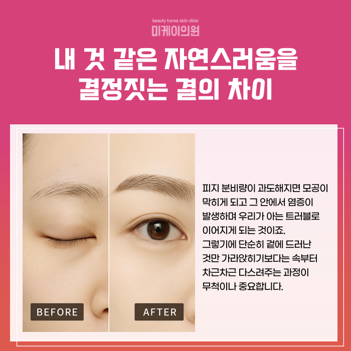 Seocho Eyebrow Tattooing Best Spot: A Design That Shapes the First Impression image 2