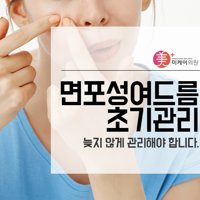 면포성여드름 초기관리 늦지 않게 관리해야 합니다. 관련 이미지 1