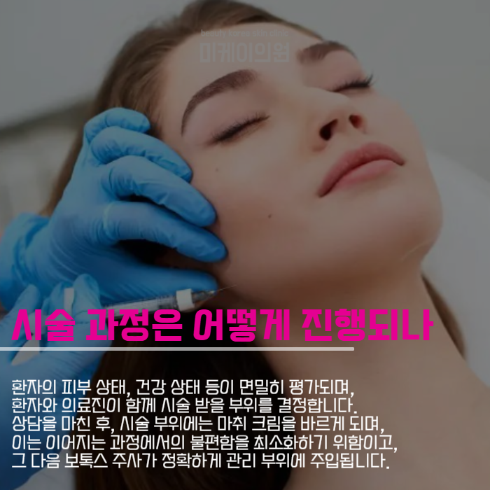 강남보톡스잘하는곳에서 자연스럽고 만족스럽게 관련 이미지 5