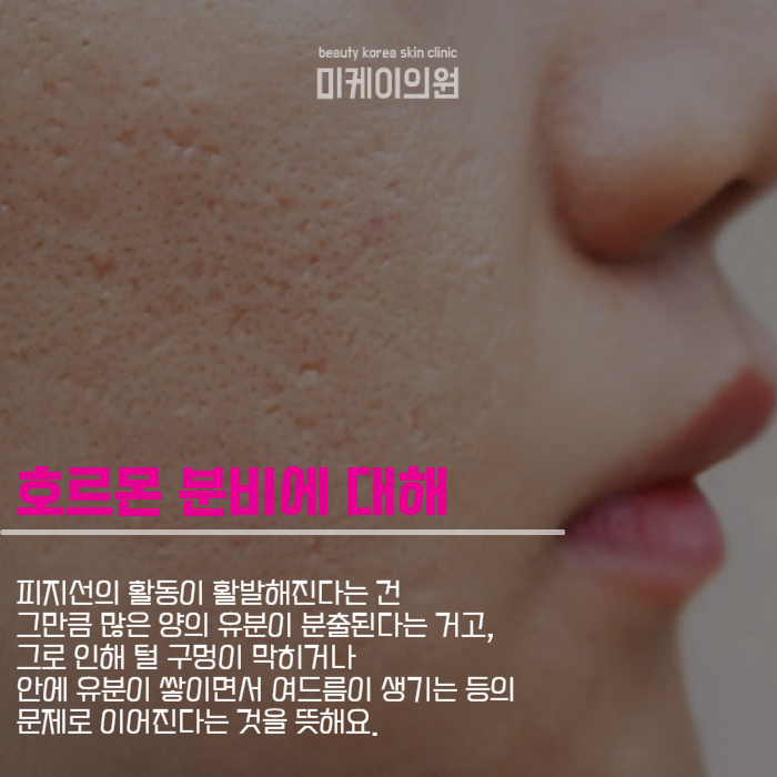 얼굴모공줄이는방법 클렌징부터 아쿠아필까지 관련 이미지 2