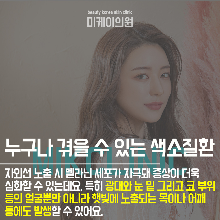 주근깨생기는원인 깔끔하게 개선하려면 관련 이미지 2