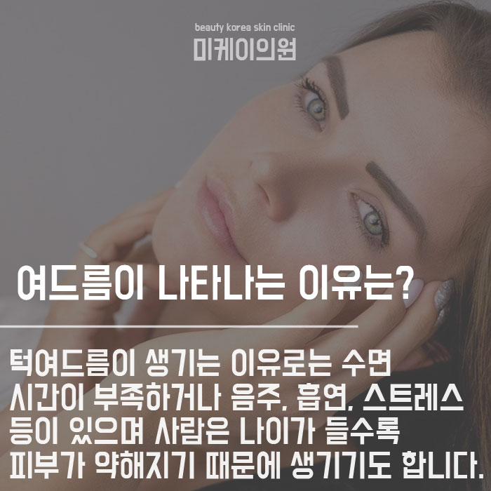 생리전 턱여드름 생기는 이유는 뭘까요 관련 이미지 2