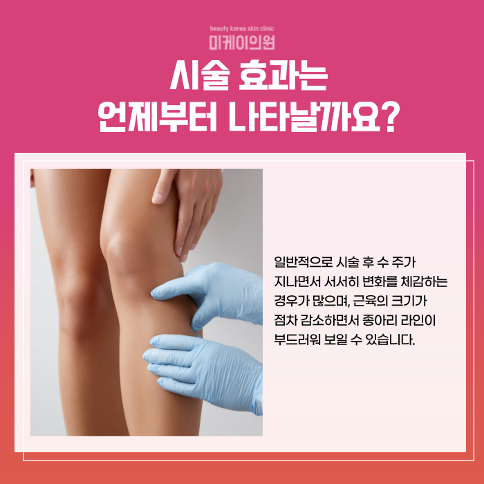 Gangnam Calf Botox: What to Do Right Away Before Summer Arrives image 3
