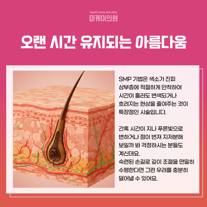 If You’re Concerned About a Thin Crown in Gangnam Seocho SMP image 3