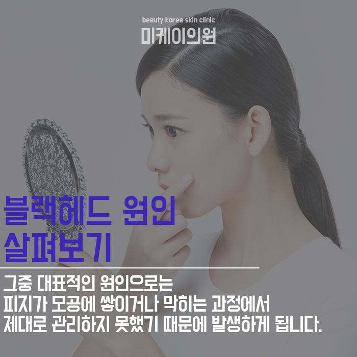 블랙헤드예방법 알고 깨끗한 피부 유지하자! 관련 이미지 2