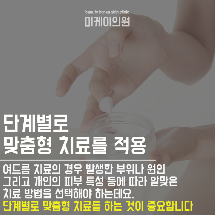 서초여드름관리 여름에도 산뜻하게 관련 이미지 4