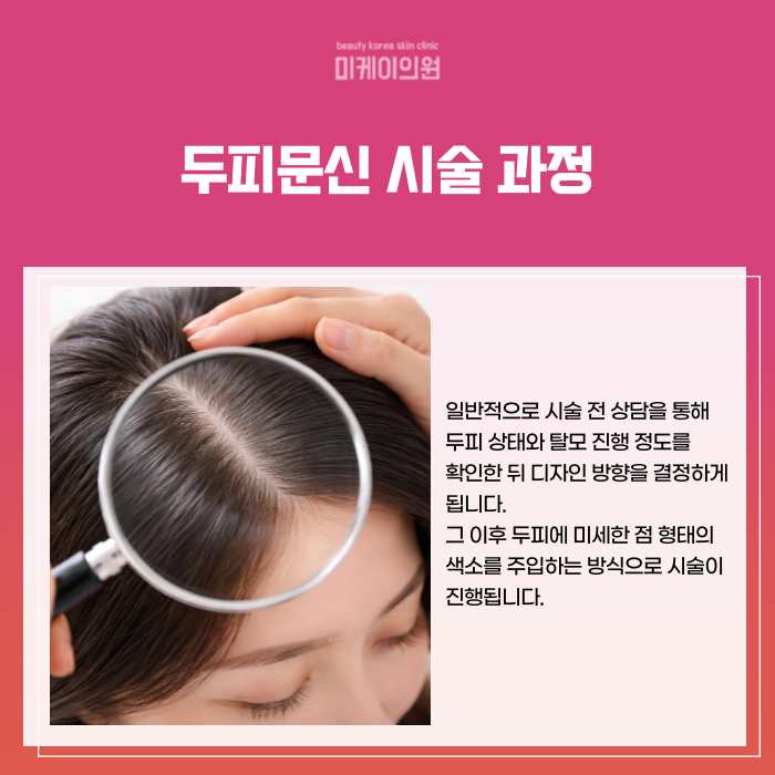 Gangnam Station Scalp Micropigmentation: How to Naturally Cover Thinning Hair image 4