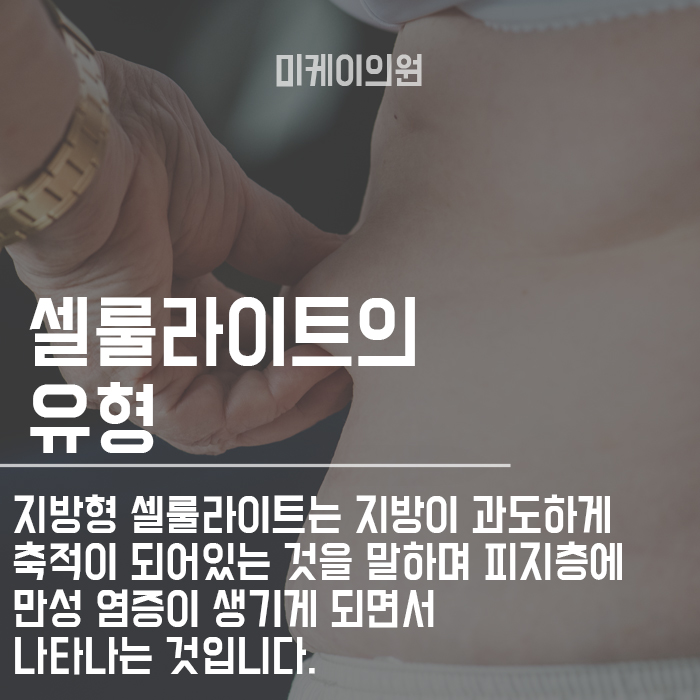 허벅지 셀룰라이트 제거시술 효과적인 것은 관련 이미지 3