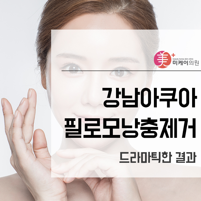 강남아쿠아필로모낭충제거 드라마틱한 결과 관련 이미지 1