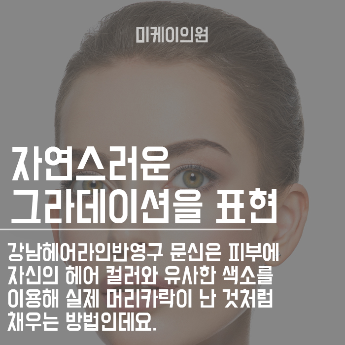 강남헤어라인반영구 빈공간 채워주고 예쁜 얼굴라인 관련 이미지 2