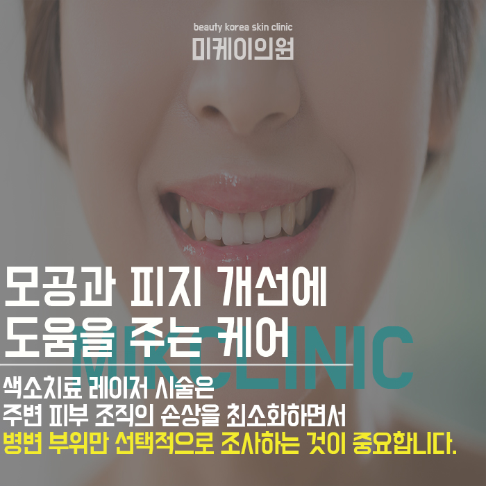 서초여드름흉터치료 변화가 눈에 보여요 관련 이미지 5