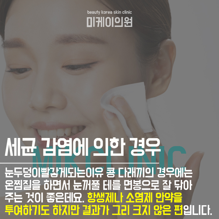 눈두덩이빨갛게되는이유 개인에 따라 달라요 관련 이미지 5