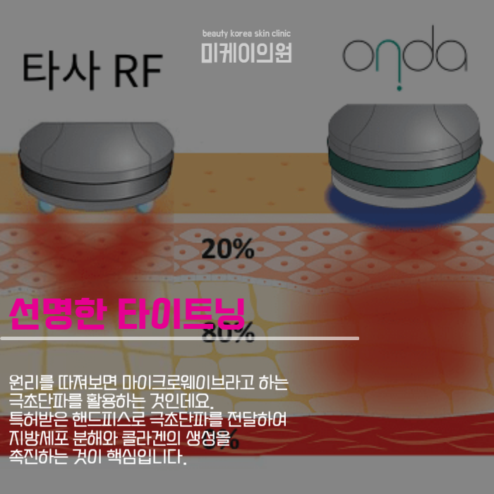 Reasons Onda Lifting Is Worth It Regardless of Price image 2