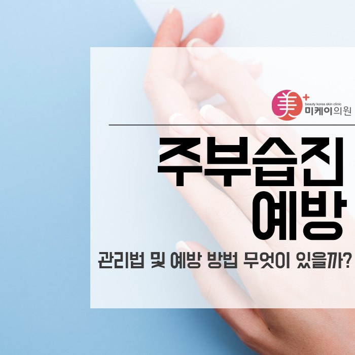 주부습진 관리법 및 예방 방법 무엇이 있을까? 관련 이미지 1