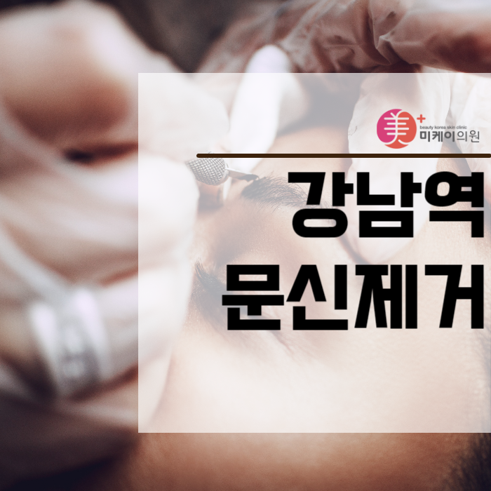강남역문신제거 엔디야그 레이저로 아름다움을 찾다 관련 이미지 1
