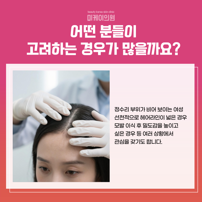 강남역 두피문신 자연스러운 빽빽한 헤어라인 관련 이미지 3