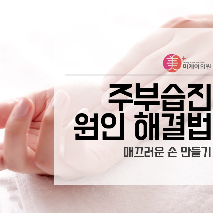 주부습진 원인 해결법 매끄러운 손 만들기 관련 이미지 1