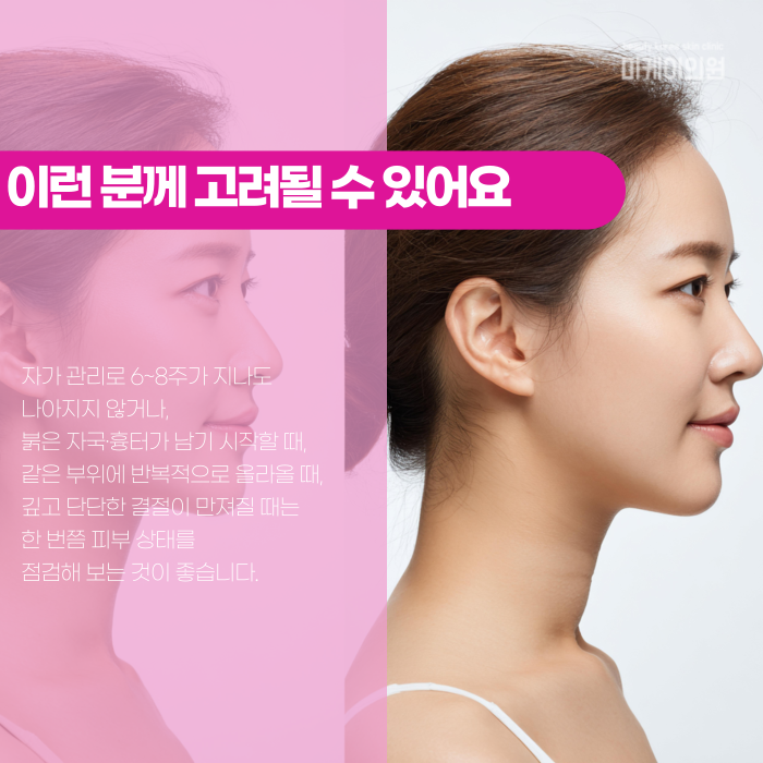 Gangnam Shurink Lifting: How Often Should You Get It? image 6