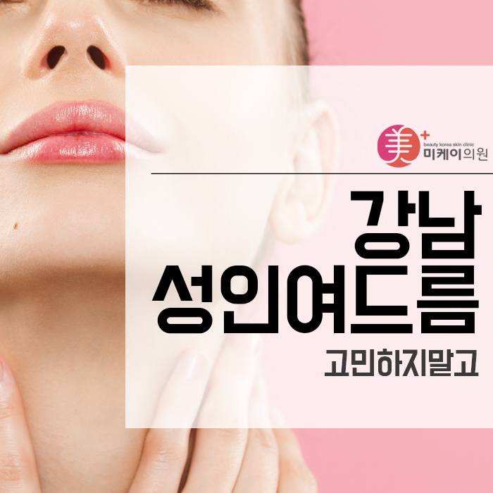 강남성인여드름 고민하지말고 관련 이미지 1