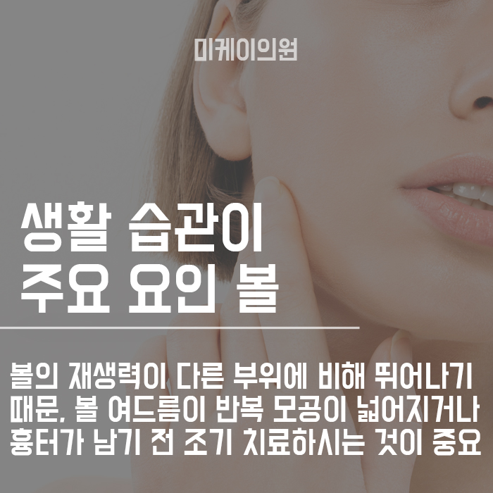 얼굴 부위별 여드름 원인 알고 관리해봐요 관련 이미지 4