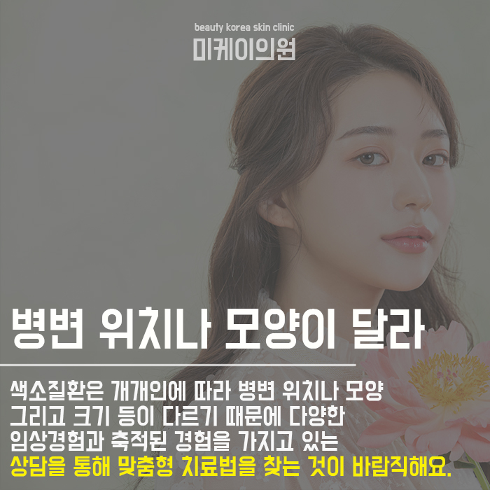 피부색소질환종류 개선하려면 관련 이미지 2
