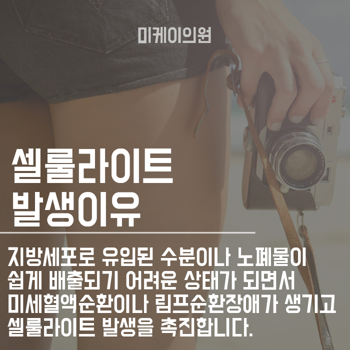 셀룰라이트 없애는방법 매끈한 다리 라인을 위하여 관련 이미지 4