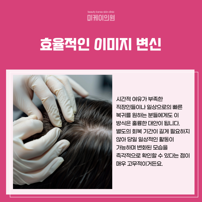 If You’re Concerned About a Thin Crown in Gangnam Seocho SMP image 4