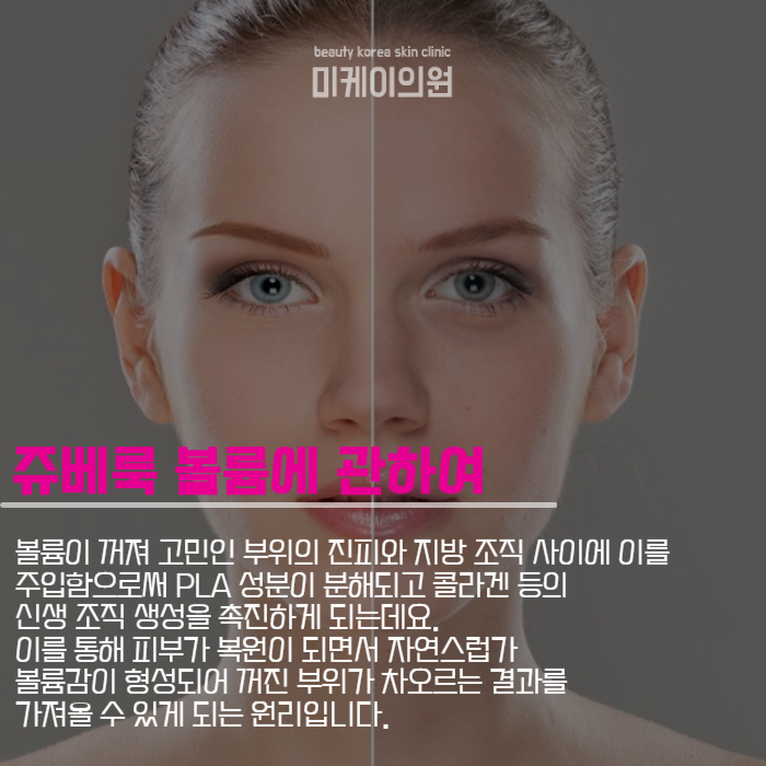 서초구 쥬베룩볼륨 자연스럽게 차올라 관련 이미지 3