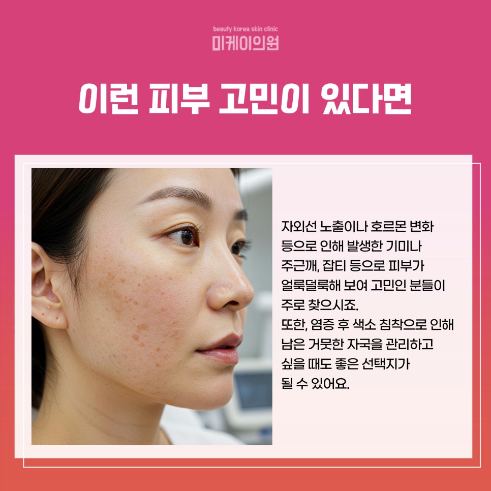 강남 피부과 레이저토닝 깨끗하고 환한 피부의 시작 관련 이미지 3