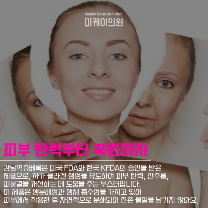 강남역쥬베룩 시술로 자연스러운 아름다움 찾기 관련 이미지 2
