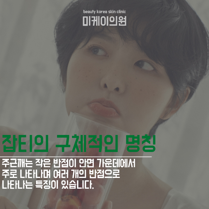 서초잡티피부과 방문이 늦지 않도록 관련 이미지 2