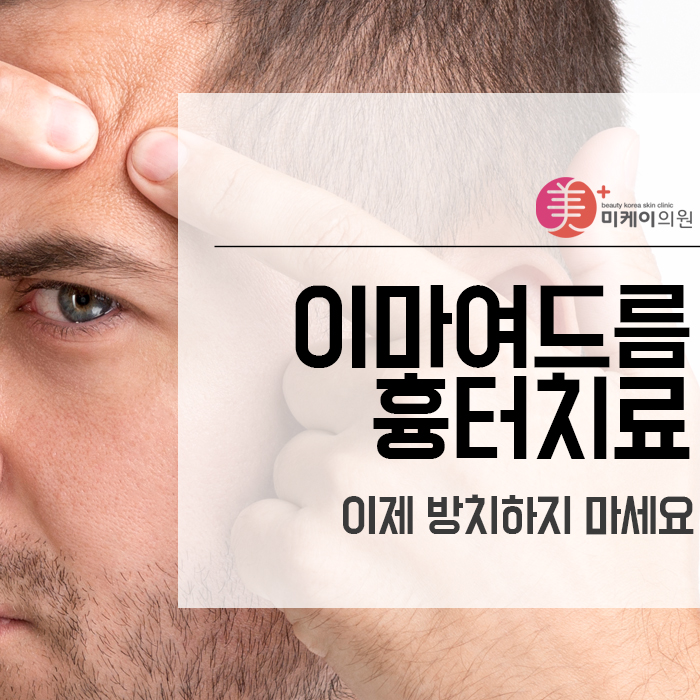 이마여드름흉터치료 이제 방치하지 마세요 관련 이미지 1