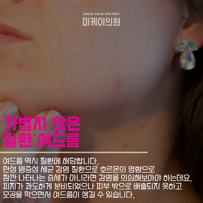 피부질환종류 비슷하게 보여도 달라요 관련 이미지 4