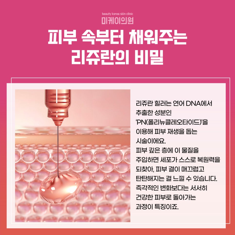 서초구 피부과 요즘 핫한 리쥬란 힐러 관련 이미지 2