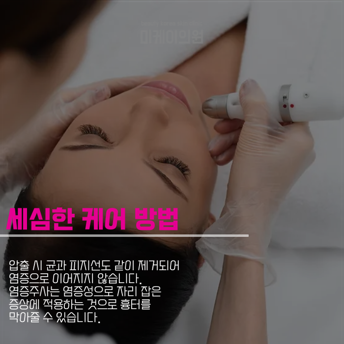 강남여드름피부과 마음의 짐을 덜려면 관련 이미지 5