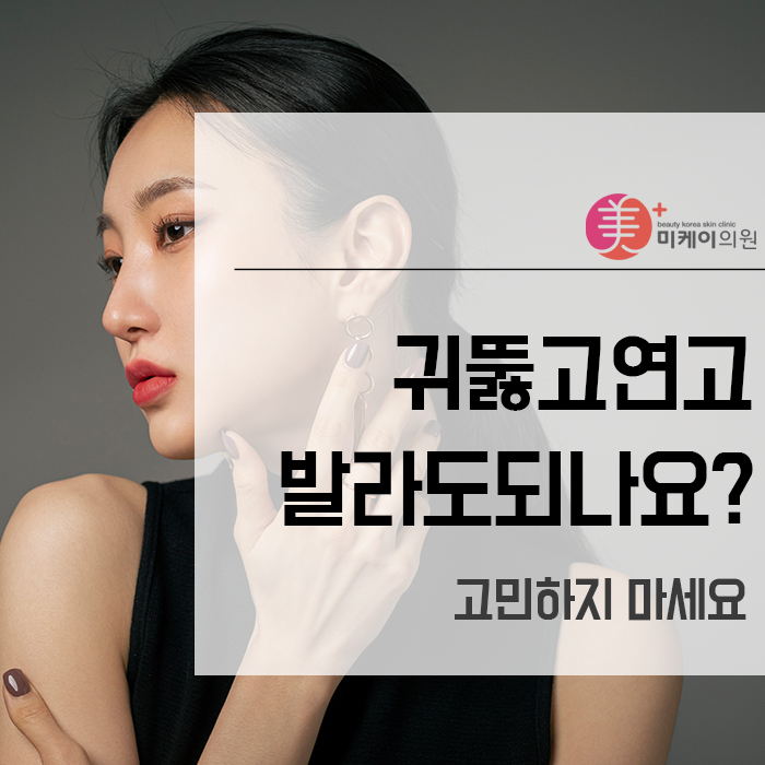 귀뚫고연고 발라도되나요? 고민하지 마세요 관련 이미지 1