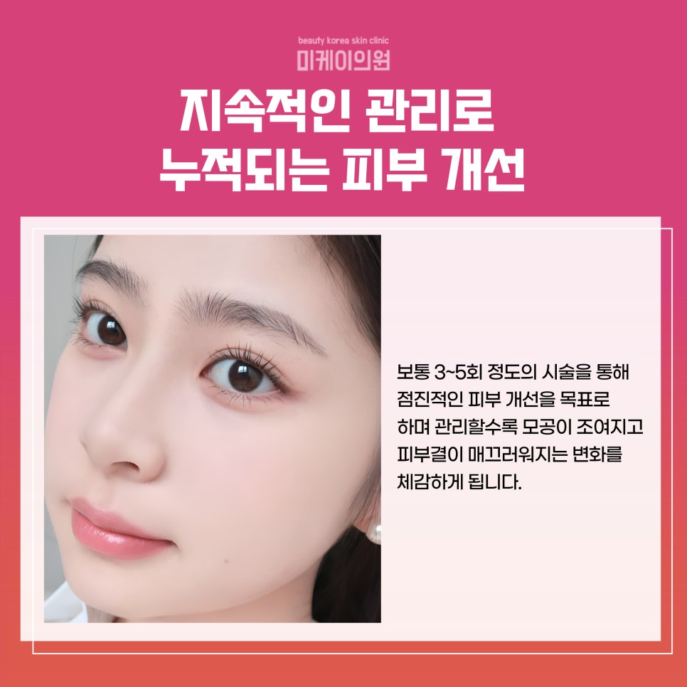 Seocho Fraxel: A New Trend in Skin Regeneration image 5