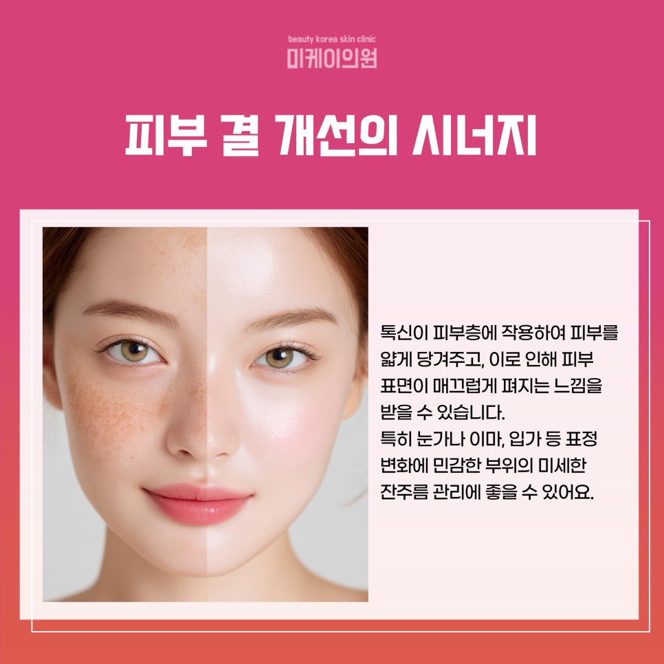 Guide to the Difference Between Dermotoxin and Botox in Gangnam image 3