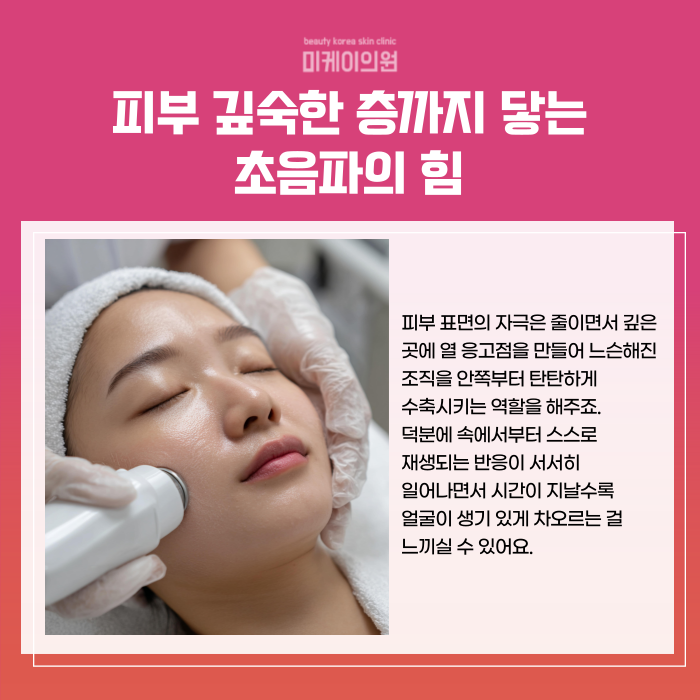 강남 울쎄라 추천 꼭 체크해야 할 리프팅 가이드 관련 이미지 3