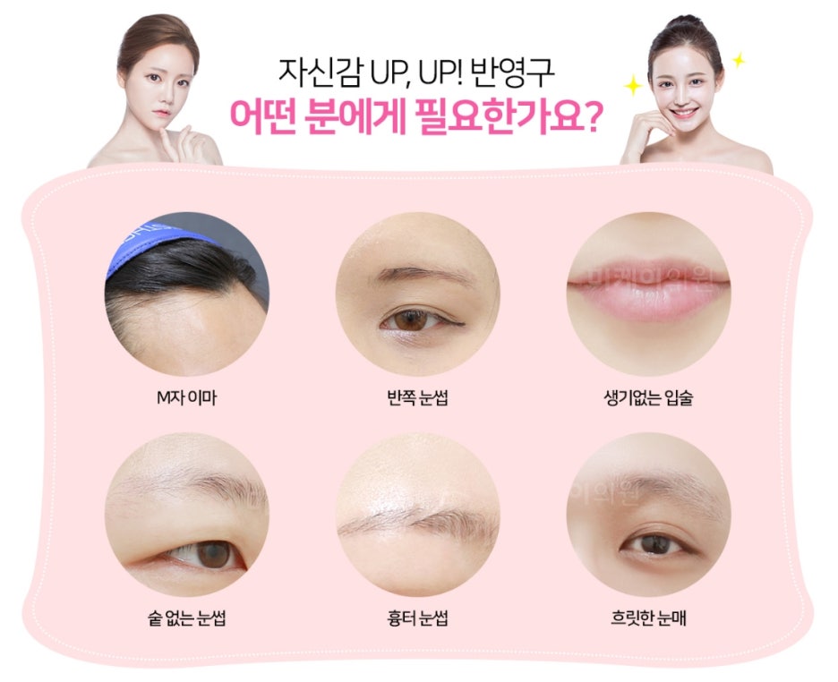 자연스러운 틴트입술반영구 미케이의원! 관련 이미지 2