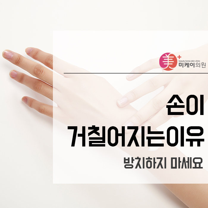 손이거칠어지는이유 방치하지 마세요 관련 이미지 1