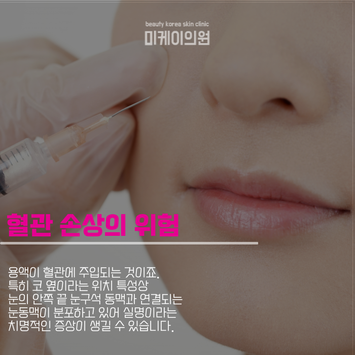 팔자주름필러 부작용 없다고 할 순 없죠 관련 이미지 3