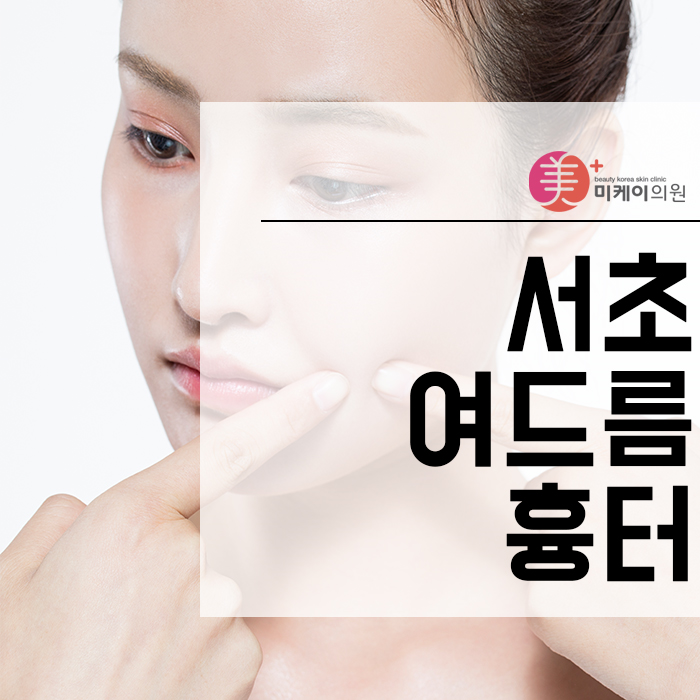 서초여드름흉터 피부가 지저분해 보이지 않도록 관련 이미지 1