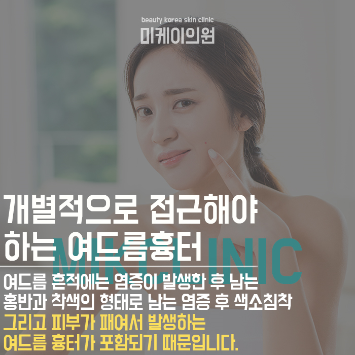 서초여드름흉터 피부가 지저분해 보이지 않도록 관련 이미지 4