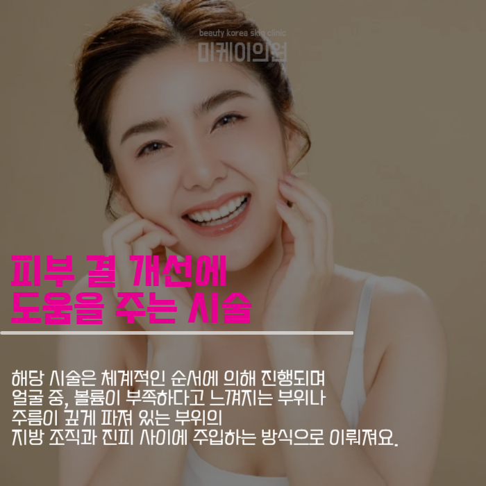 쥬베룩볼륨효과 나에게 맞는 시술 찾기 관련 이미지 2