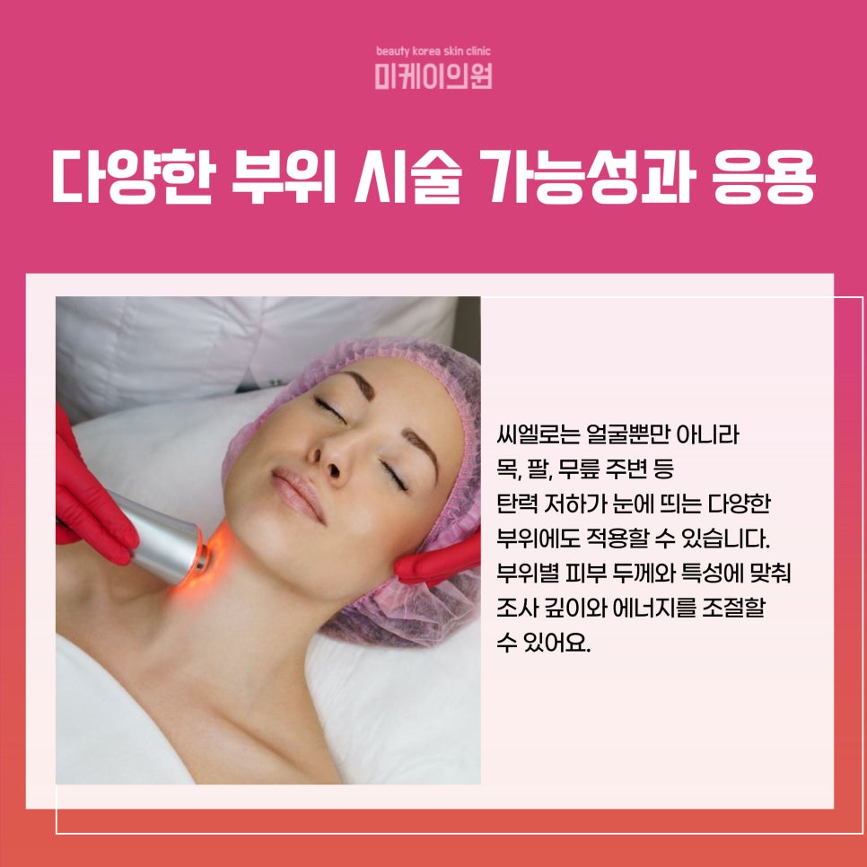 강남 피부과의원 씨엘로 시술의 모든 것 관련 이미지 5
