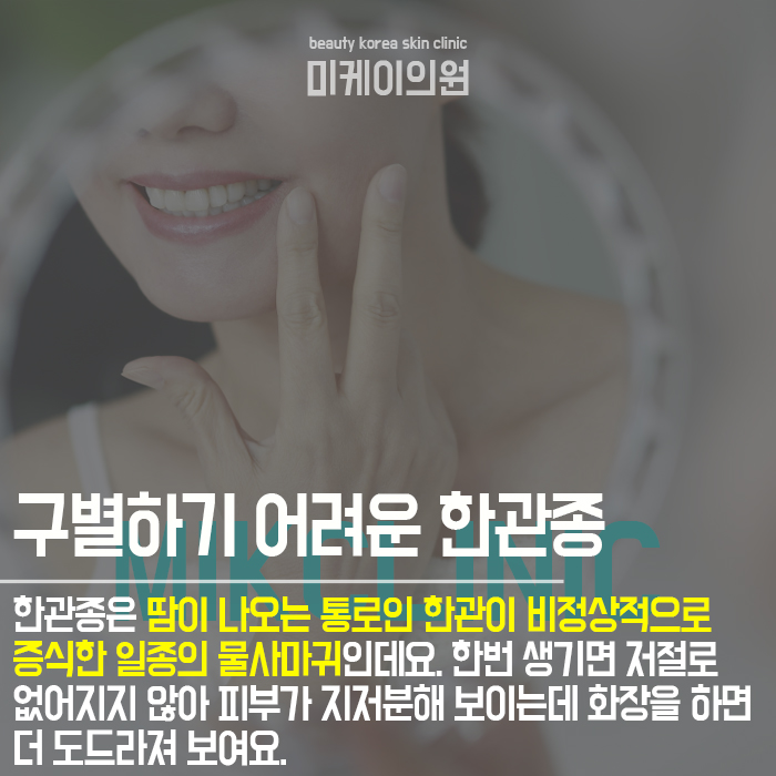 한관종생기는이유 개인마다 다를 수 있어 관련 이미지 2